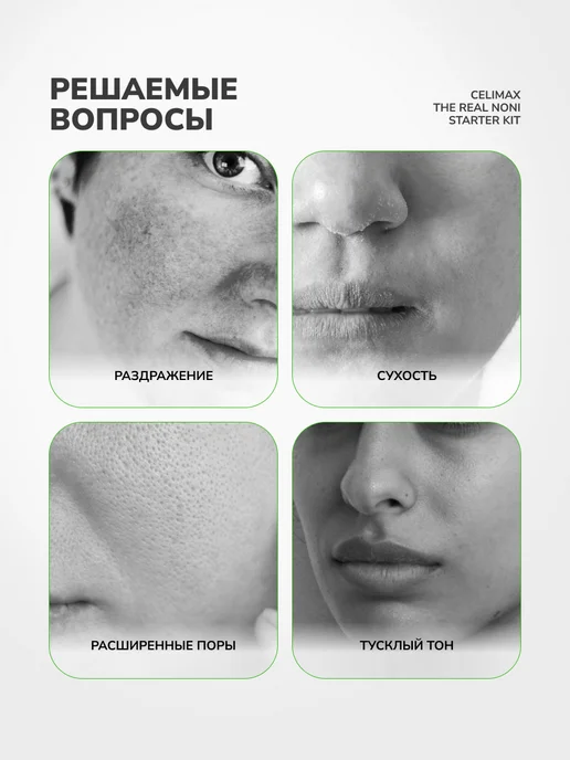 Celimax Восстанавливающий набор миниатюр с нони The Real Noni Starte…, вариант, фото 3