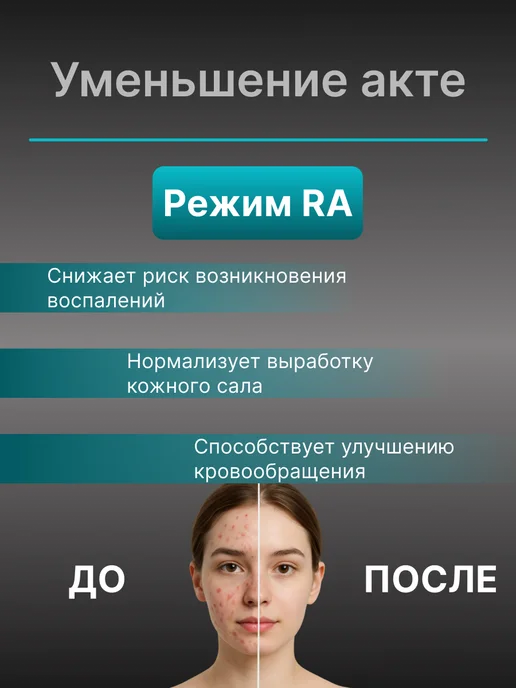 Лазерный фотоэпилятор для удаления волос, белый, фото 6