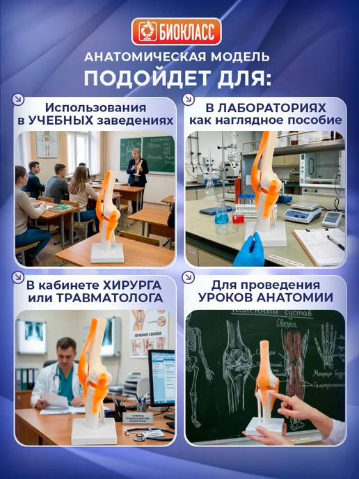 БИОКЛАСС Макет коленного сустава человека на подставке, вариант, фото 2