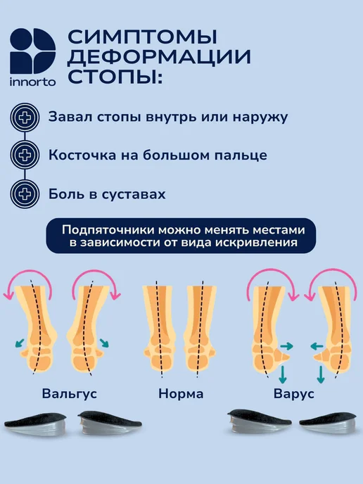INNORTO Ортопедические стельки вальгус подпяточник, черный, фото 2