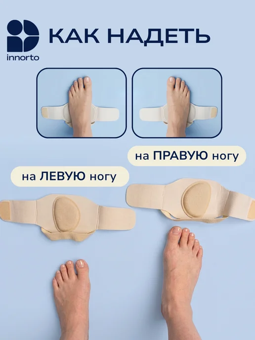 INNORTO Супинаторы ортопедические при плоскостопии, 2 шт, фото 8