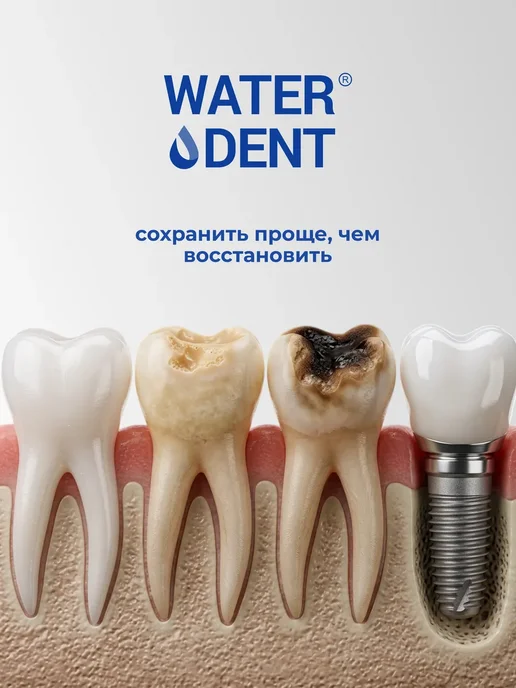 Waterdent Антибактериальная пенка для очищения языка, 50 мл, фото 8