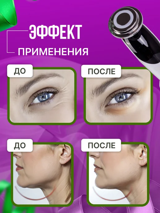 МАСТЕР СКЛАД Массажер электрический для лица и шеи RF-лифтинг, белый, фото 2