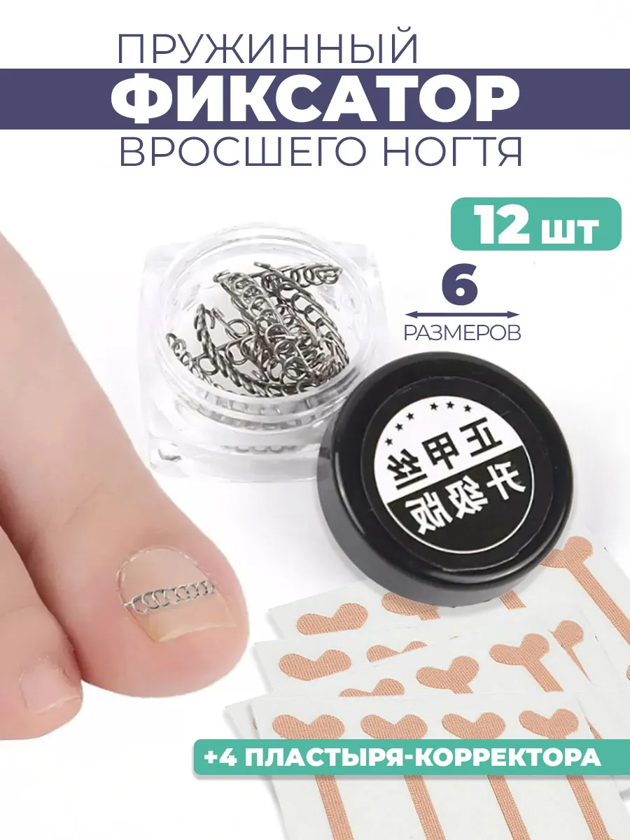 Корректор для вросшего ногтя скобы пластырь корректор